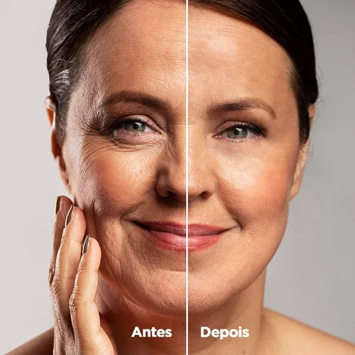 Antes-x-Depois-Rosa-Mosqueta