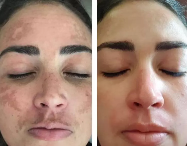 resultados-rosa-amazonica