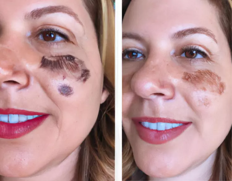 resultados-rosa-mosqueta-amazonica